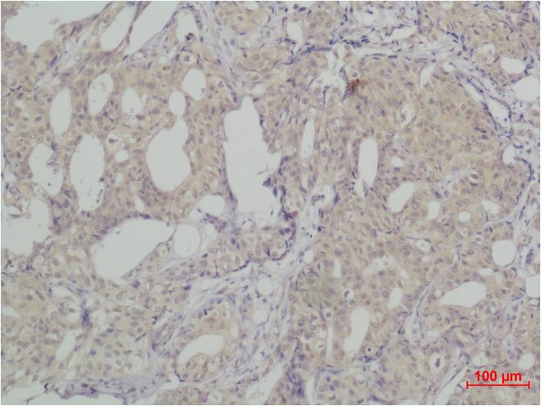Anti-SLUG Rabbit Polyclonal Antibody