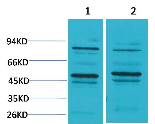 Anti-Bestrophin 2 Rabbit Polyclonal Antibody