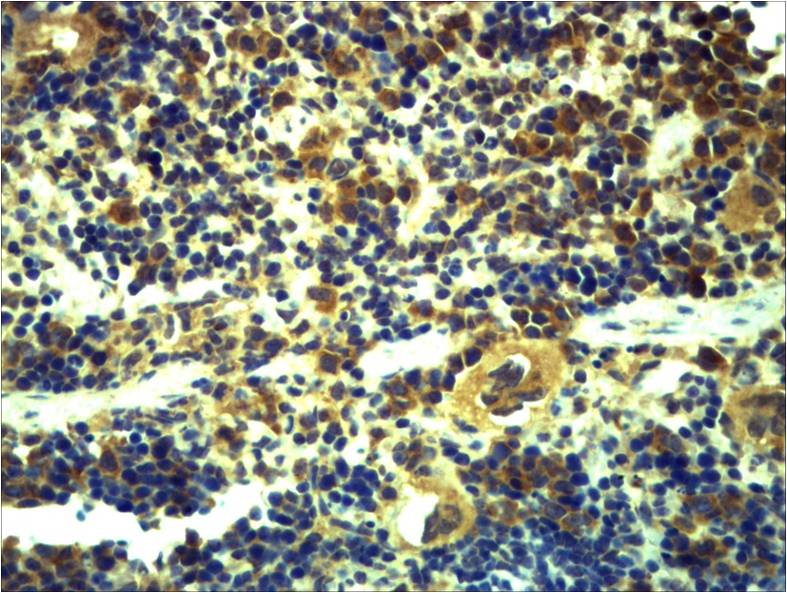 Anti-Toll-Like Receptor 6 Rabbit Polyclonal Antibody