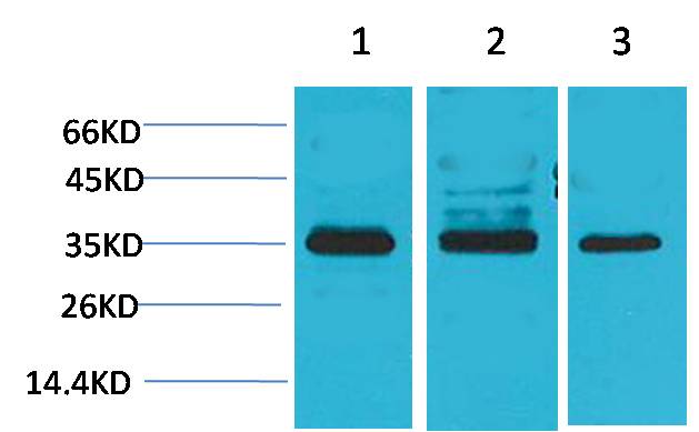 Anti-Cav gamma 4 Rabbit Polyclonal Antibody