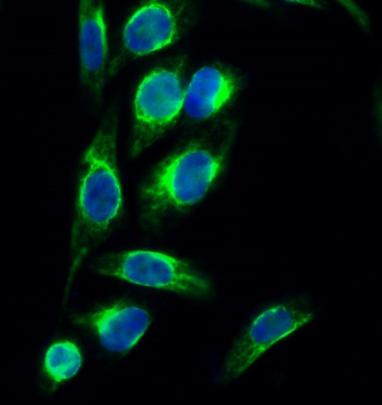 Anti-PERK Rabbit Polyclonal Antibody