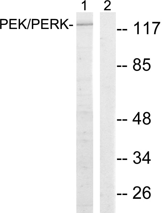 Anti-PERK Rabbit Polyclonal Antibody
