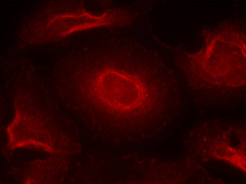 Anti-NMDAR2B Rabbit Polyclonal Antibody