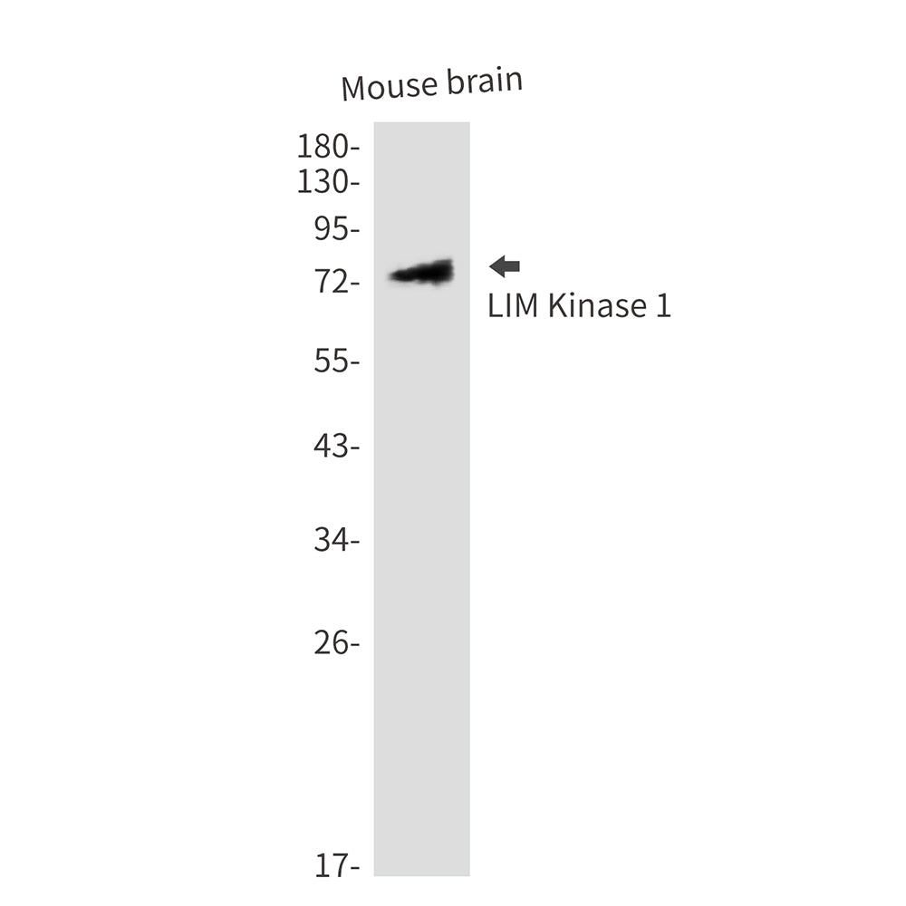 Anti-LIM Kinase 1 Rabbit Polyclonal Antibody