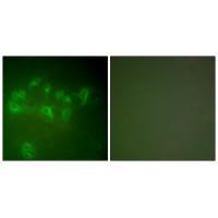 Anti-MDM2 Rabbit Polyclonal Antibody