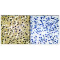 Anti-MDM2 Rabbit Polyclonal Antibody