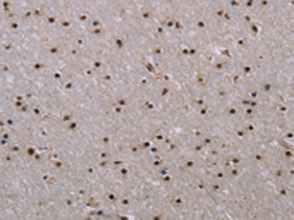 Anti-JMJD6 (Rabbit Polyclonal Antibody