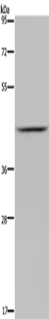 Anti-JMJD6 (Rabbit Polyclonal Antibody