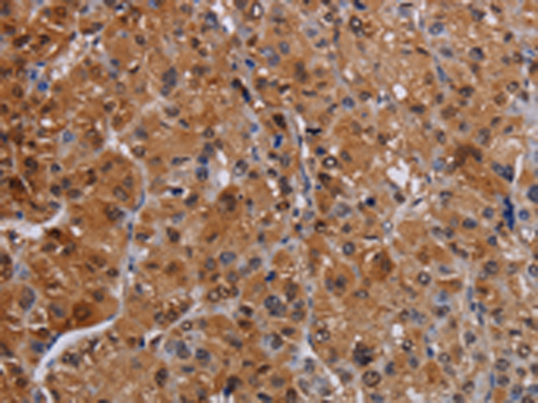 Anti-PINCH Rabbit Polyclonal Antibody