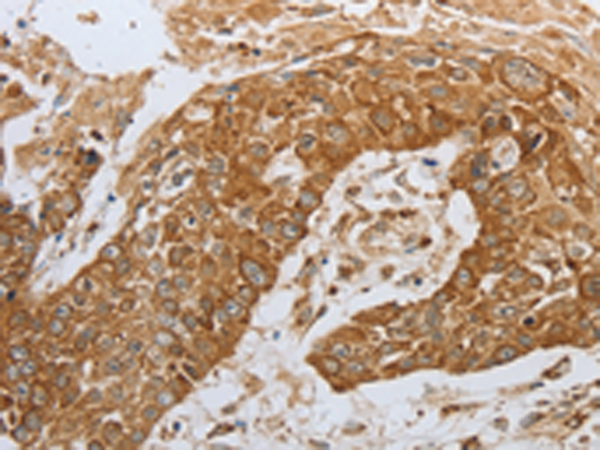 Anti-CKM Rabbit Polyclonal Antibody
