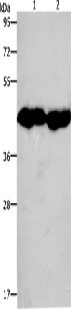 Anti-CKM Rabbit Polyclonal Antibody
