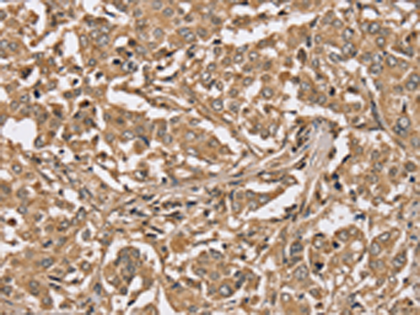 Anti-PP1C gamma Rabbit Polyclonal Antibody