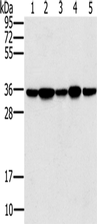 Anti-PP1C gamma Rabbit Polyclonal Antibody