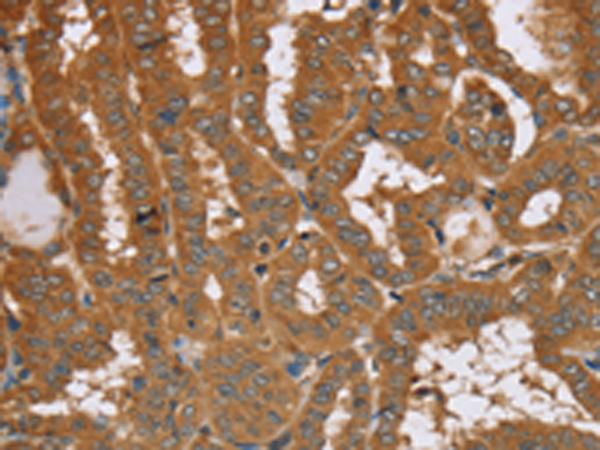 Anti-Rab14 Rabbit Polyclonal Antibody