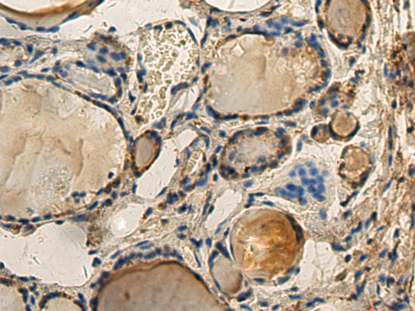 Anti-PPM1A Rabbit Polyclonal Antibody