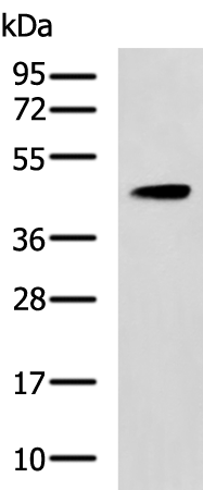 Anti-PPM1A Rabbit Polyclonal Antibody