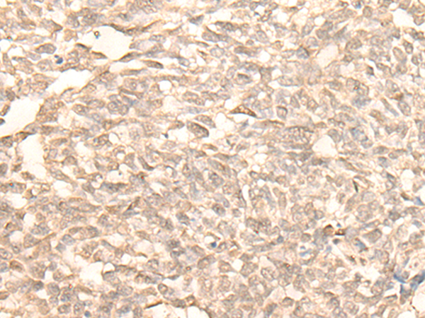 Anti-Rad23B Rabbit Polyclonal Antibody