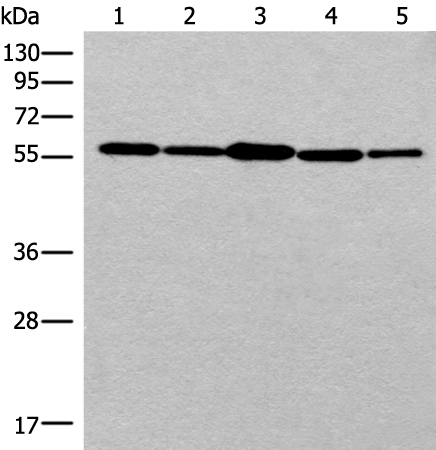 Anti-Rad23B Rabbit Polyclonal Antibody