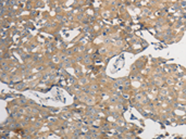 Anti-PP2A alpha/beta Rabbit Polyclonal Antibody