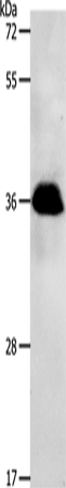 Anti-PP2A alpha/beta Rabbit Polyclonal Antibody