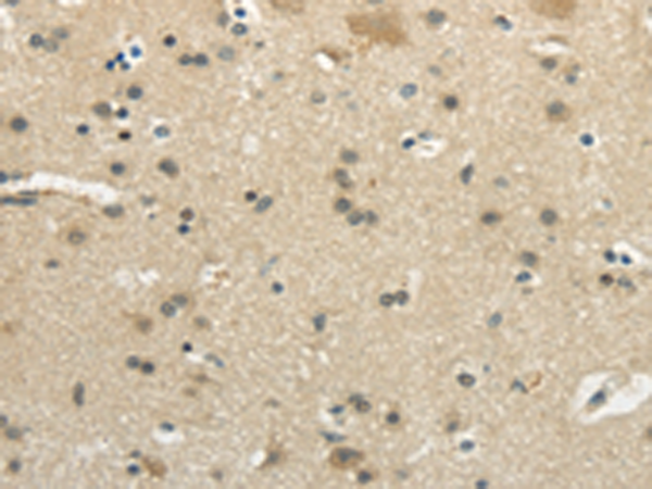 Anti-WNK2 Rabbit Polyclonal Antibody