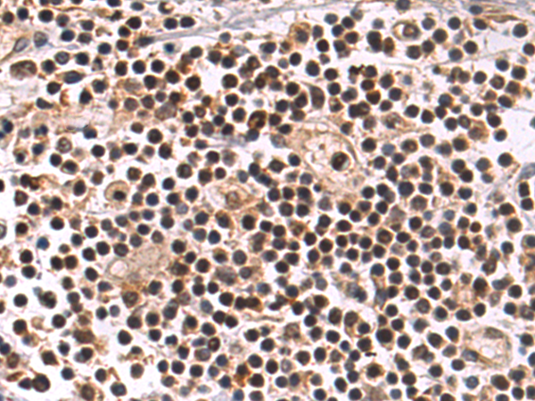 Anti-RNF114 Rabbit Polyclonal Antibody