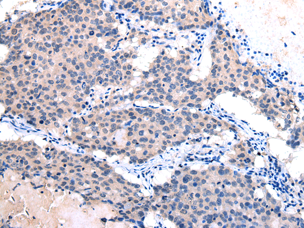 Anti-CCN6 Rabbit Polyclonal Antibody
