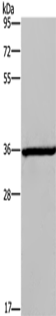 Anti-DIO2 Rabbit Polyclonal Antibody