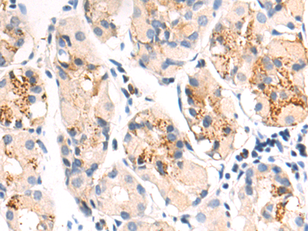 Anti-PEDF Rabbit Polyclonal Antibody