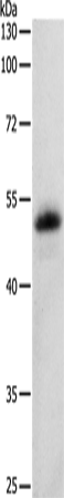 Anti-PEDF Rabbit Polyclonal Antibody