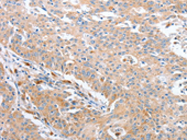 Anti-Wnt3a Rabbit Polyclonal Antibody
