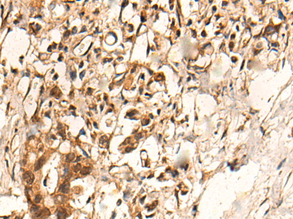 Anti-PFKFB4 Rabbit Polyclonal Antibody