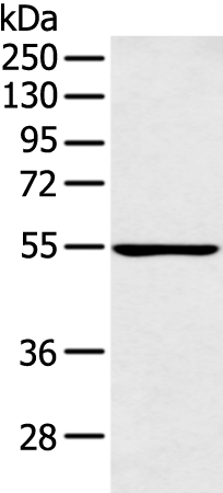 Anti-PFKFB4 Rabbit Polyclonal Antibody