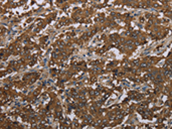 Anti-ME1 Rabbit Polyclonal Antibody