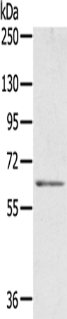 Anti-ME1 Rabbit Polyclonal Antibody