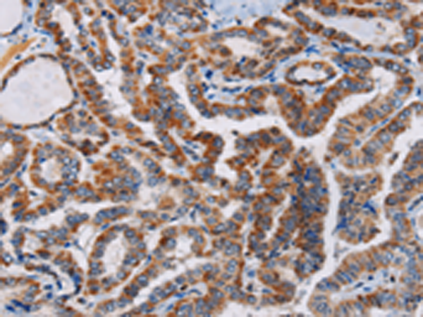 Anti-Phospholipase C beta 3 Rabbit Polyclonal Antibody