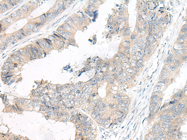 Anti-FGF10 Rabbit Polyclonal Antibody