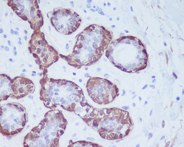 Anti-Calponin 1 Rabbit Polyclonal Antibody