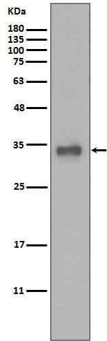 Anti-Calponin 1 Rabbit Polyclonal Antibody