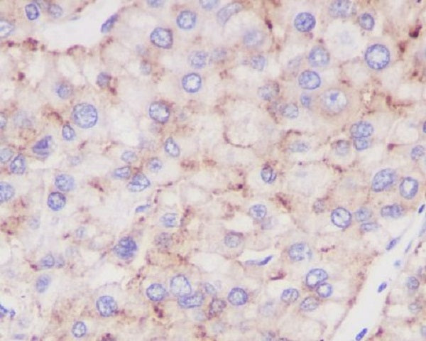 Anti-LAMP2 Rabbit Polyclonal Antibody