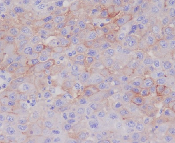 Anti-P Glycoprotein Rabbit Polyclonal Antibody