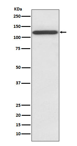 Anti-NMDAR1 Rabbit Polyclonal Antibody