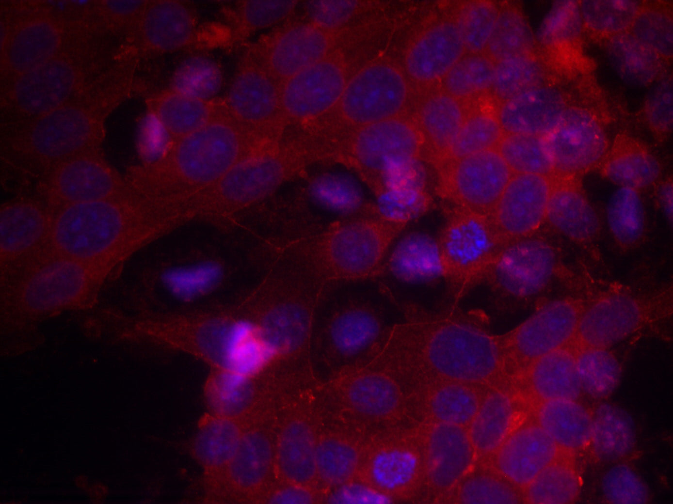 Anti-IGF1 Receptor Rabbit Polyclonal Antibody