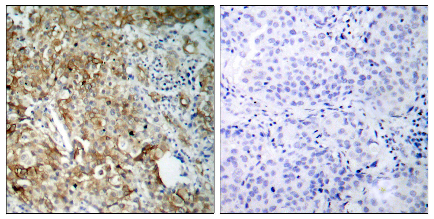 Anti-IGF1 Receptor Rabbit Polyclonal Antibody