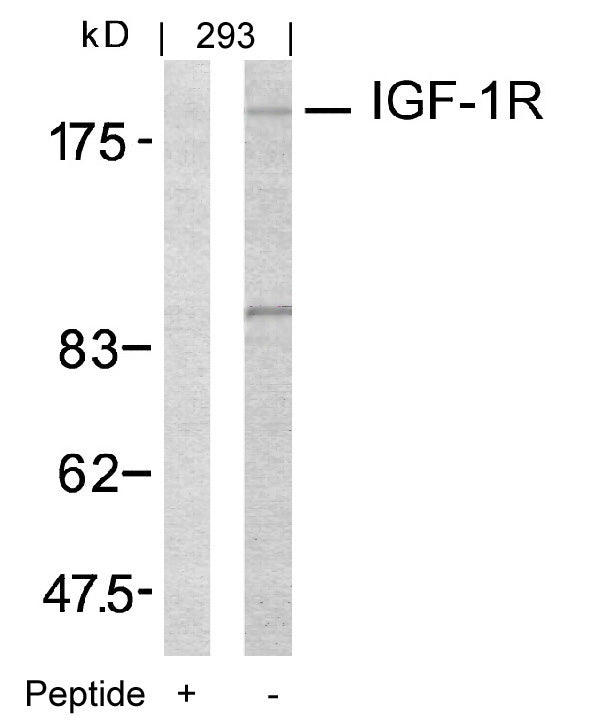 Anti-IGF1 Receptor Rabbit Polyclonal Antibody