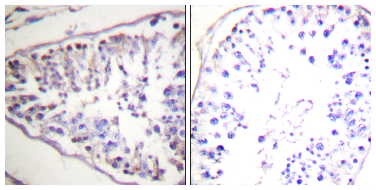 Anti-Hormone Sensitive Lipase Rabbit Polyclonal Antibody