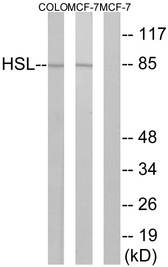 Anti-Hormone Sensitive Lipase Rabbit Polyclonal Antibody