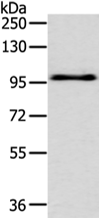 Anti-Phospho-EphA3 (Tyr596) Rabbit Polyclonal Antibody