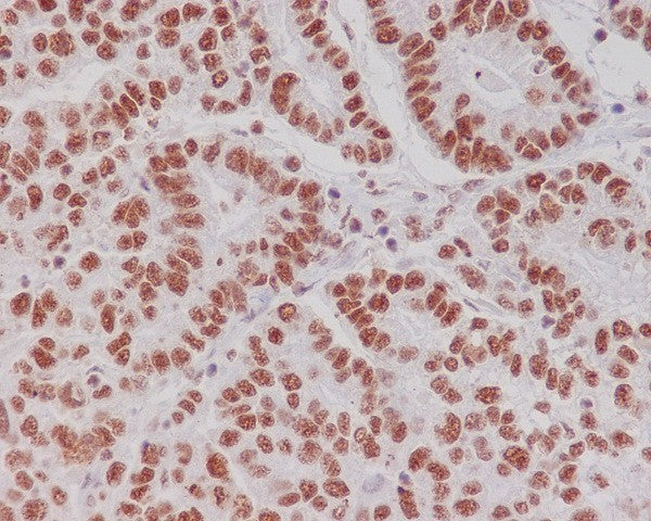 Anti-Phospho-CREB (Ser133) Rabbit Polyclonal Antibody
