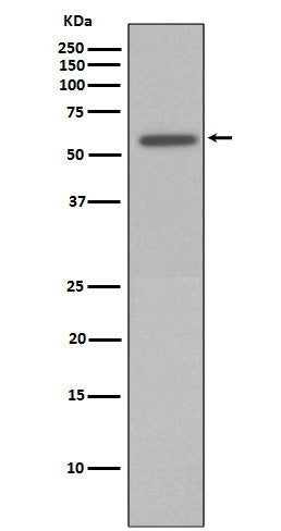 Anti-Phospho-Vimentin (Ser72) Rabbit Polyclonal Antibody